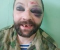 Охраняли клуб до смерти.