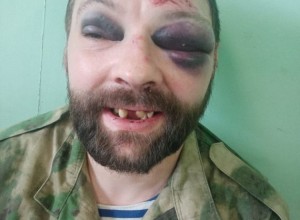 Охраняли клуб до смерти.